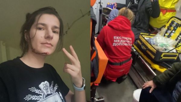 «Мы живы. Малого успела спрятать». Истории людей, пострадавших от массированного удара по Киеву и Харькову